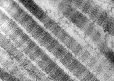 Collagen fibres at 50nm (nano-meter) magnification